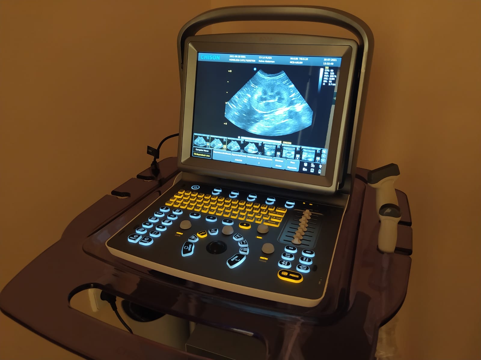 Servicio de ecografía